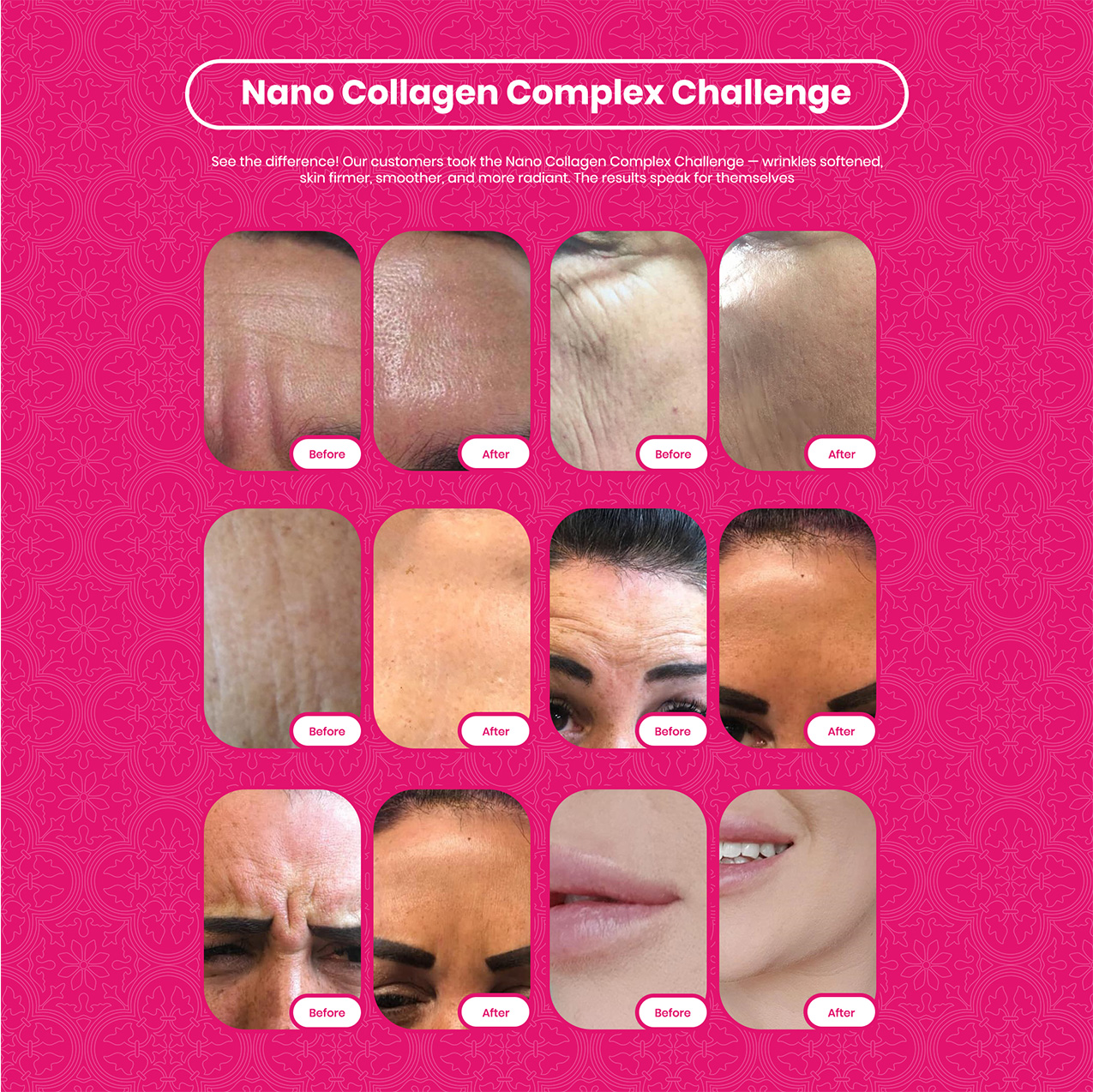 Collagen Complex Nano Collagen Types 1, 2, 3, 5 & 10, Max Collagen ...
