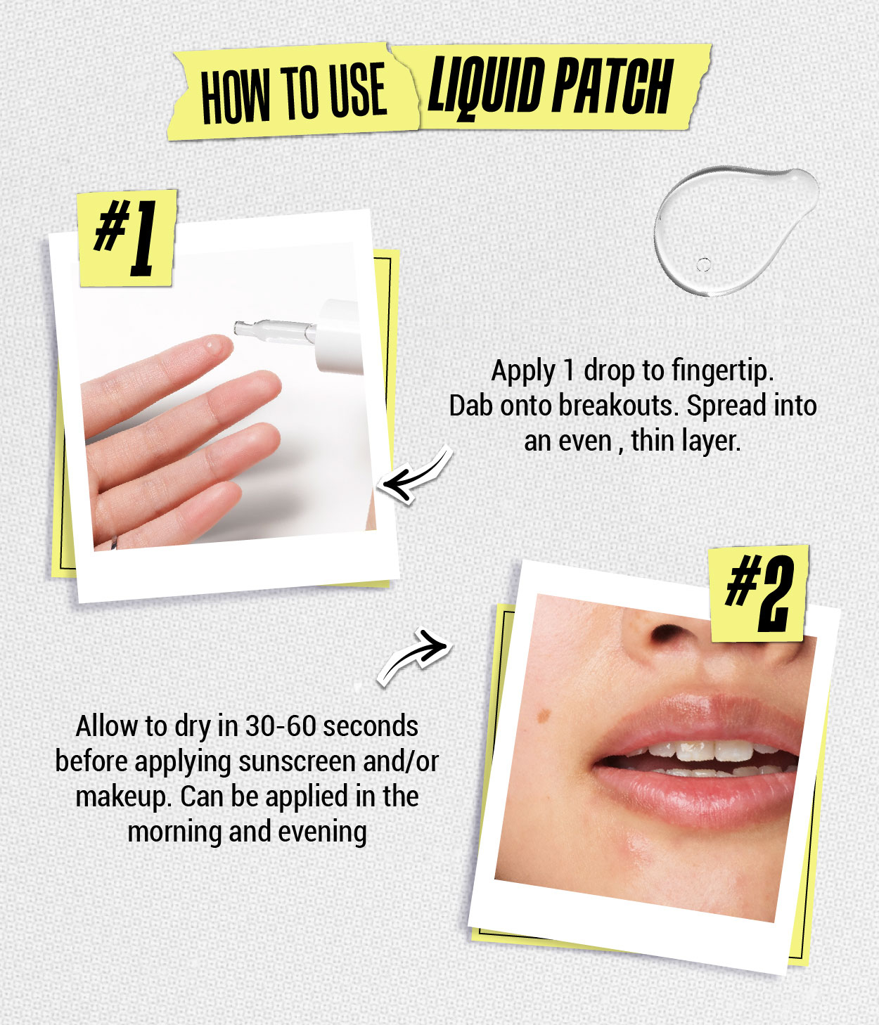 Kiehl's Truly Targeted Blemish-Clearing Solution Pimple Patch with ...