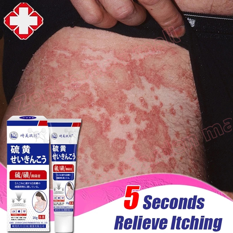 Japan Anti Itch Cream Eczema Cream Antifungal Cream Psoriasis ...