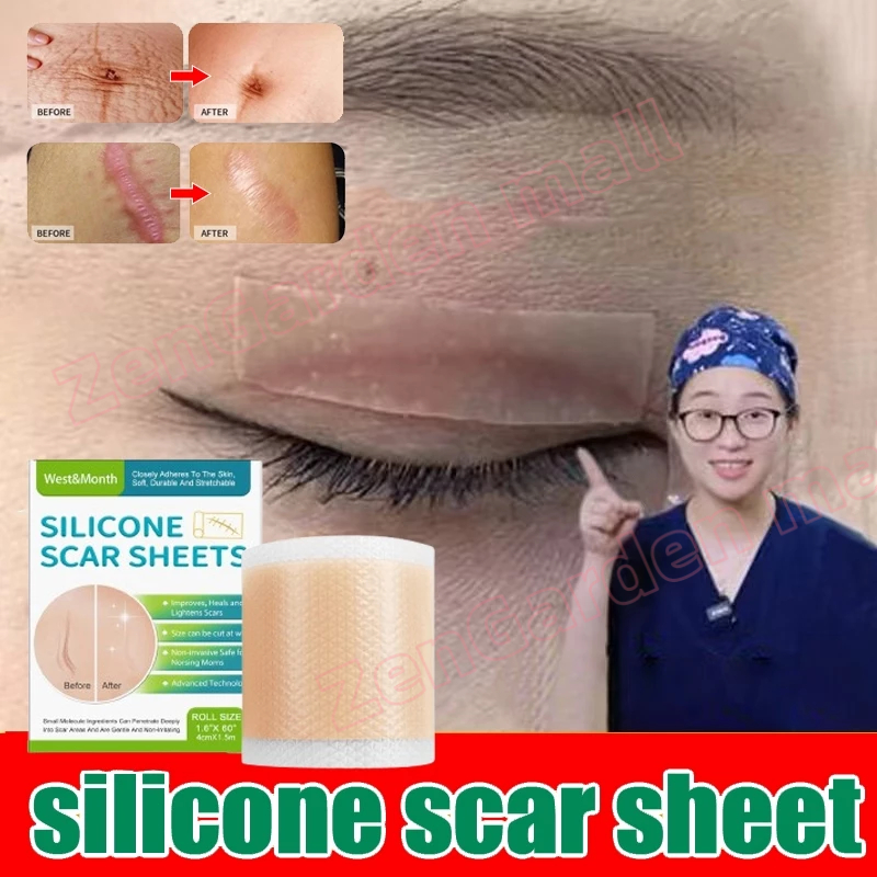 Scar Patch Silicone Scar Sheet Scar Removal Patch Keloid Scar Plaster ...
