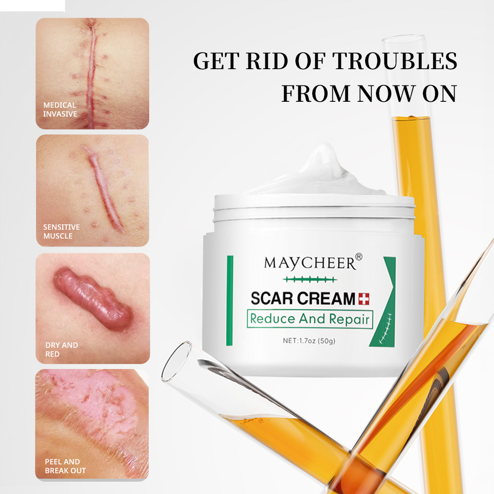 Product image Scar Cream Reduce And Repair  For Face&Body Rejuvenate Restore Skin 50g 1