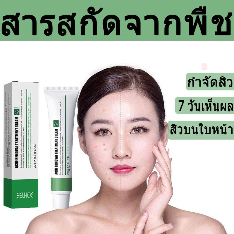 Picture of best oils for acne prone skin - TikTok Shop