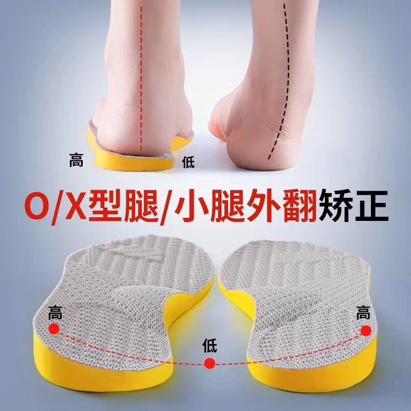 Adult talipes valgus, inside and outside, improv Adult xoshaped legs