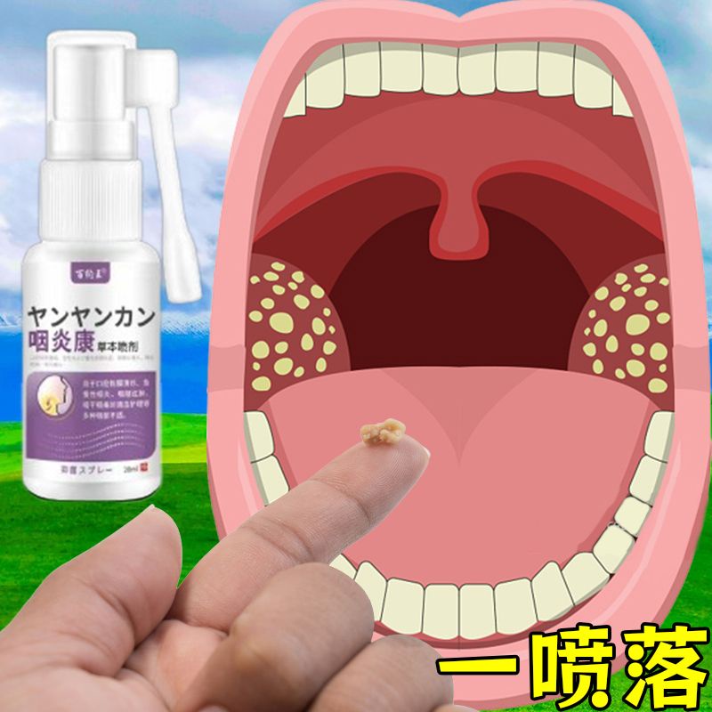 Tonsil stone spray tool for removing crypts, tonsils for bad breath ...