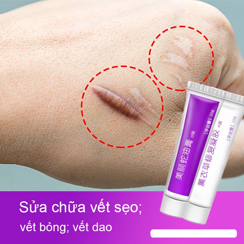 Blurring Scarring Cream For Acne Scars Reducing Acne Scars Recover Burn