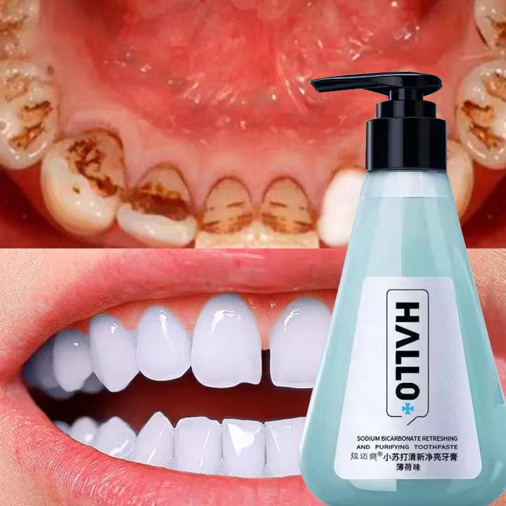 Toothpaste Whitening Toothpaste Removes Bad Teeth Bleaching Yellowing