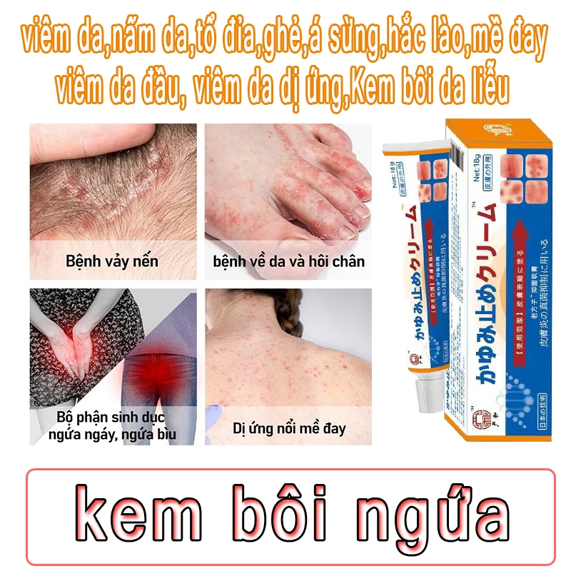 Kobayashi, Urticaria Instant Relief Cream, Rashes, Jaundice And Cement ...