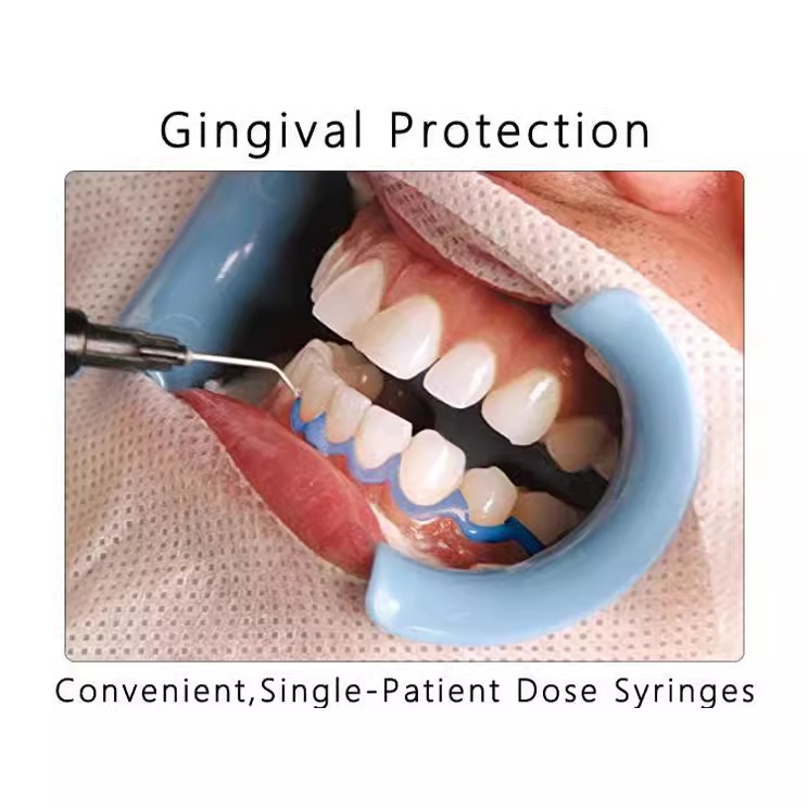 Gum cover and protector used in teeth whitening (cheap type) | Shopee ...