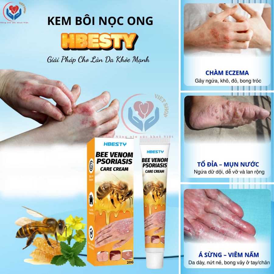HBESTY HONEY CREAM 20G, REDUCE ECZEMA ECZEMA ITCHING, leech nests ...