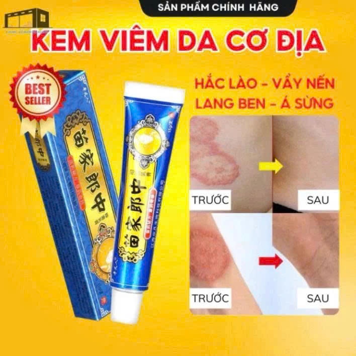 (Combo of 3 tips) Atopic Dermatitis Topical Cream Effectively ...