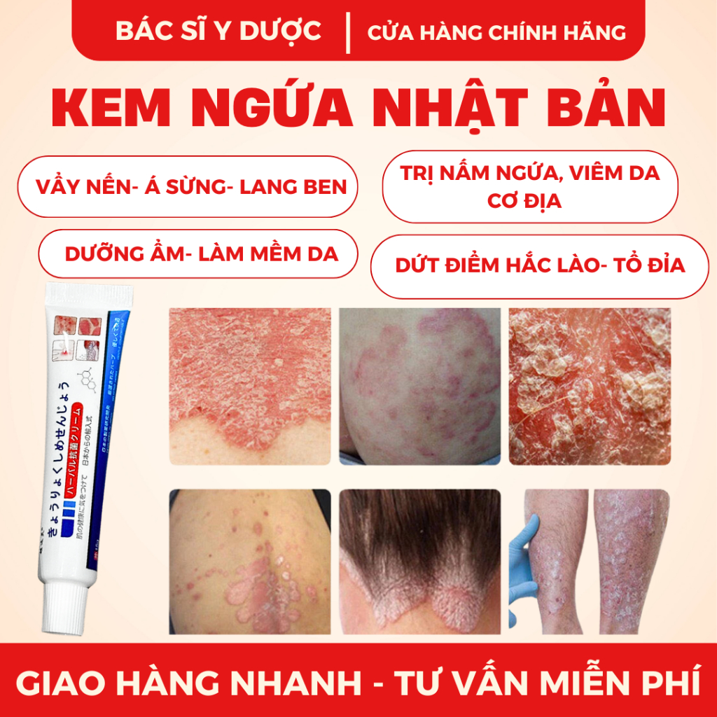 5 GET 1 FREE JAPANESE Topical Cream for Itchy Fungus, Atopic Dermatitis ...